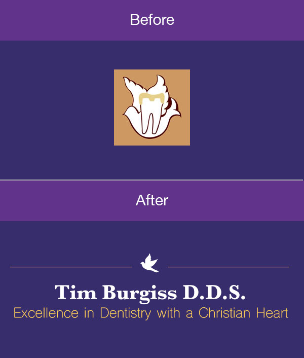 before and after burgiss logo
